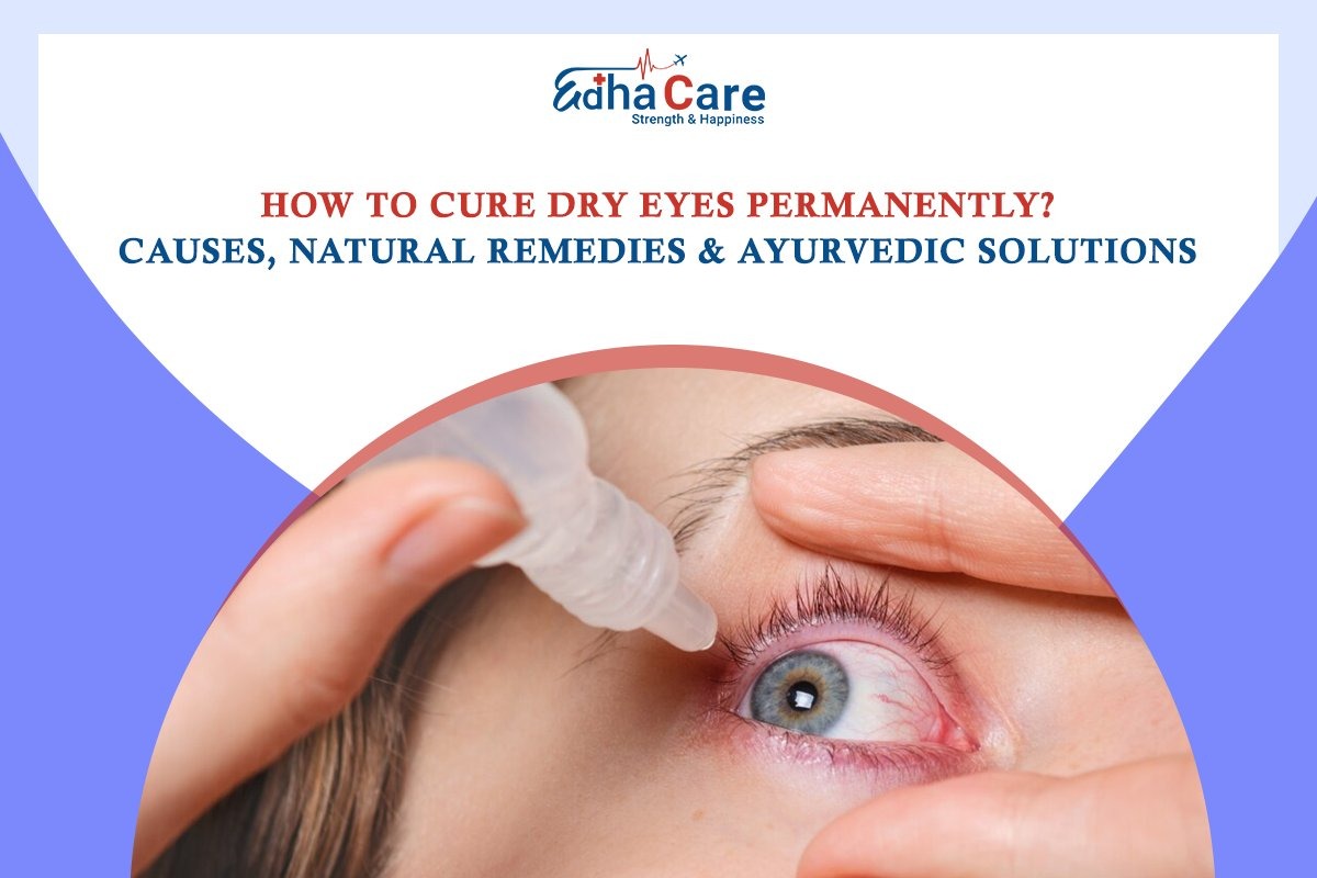 How to Cure Dry Eyes Permanently