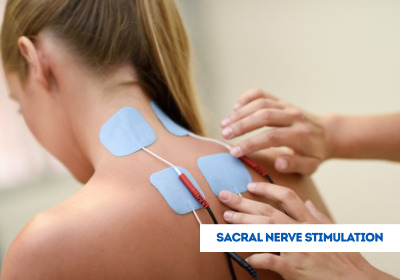 Sacral Nerve Stimulation Procedure in India