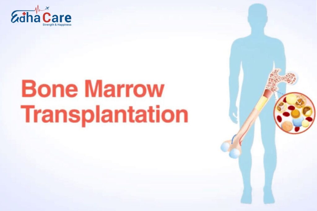 Bone Marrow Transplant in India