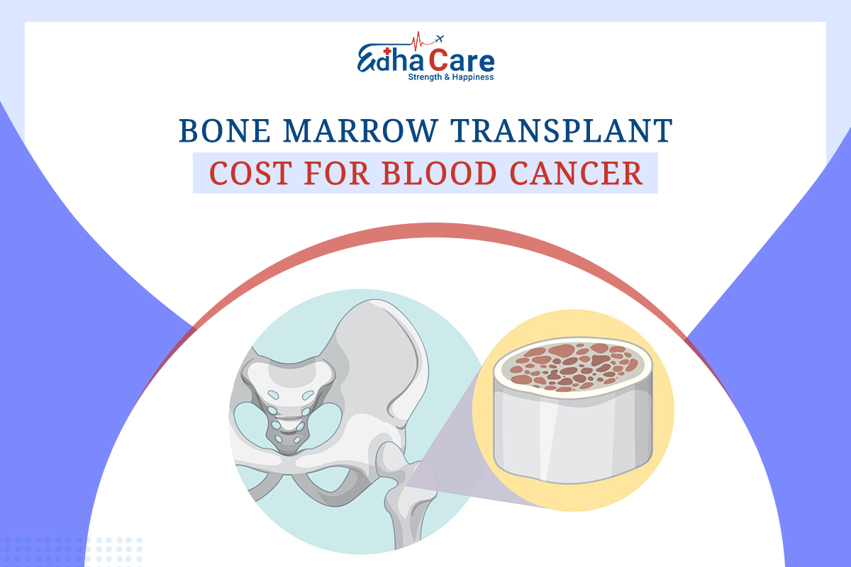 Bone Marrow Transplant Cost for Blood Cancer