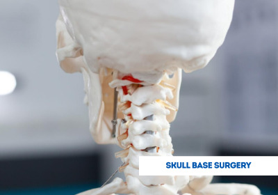 Skull Base Surgery in India