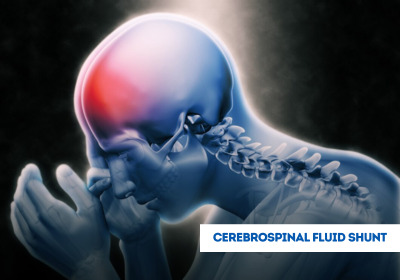 CFS Treatment in India