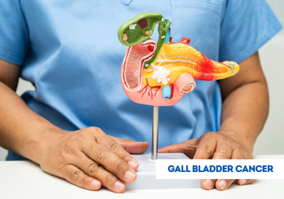 Gallbladder Cancer Treatment