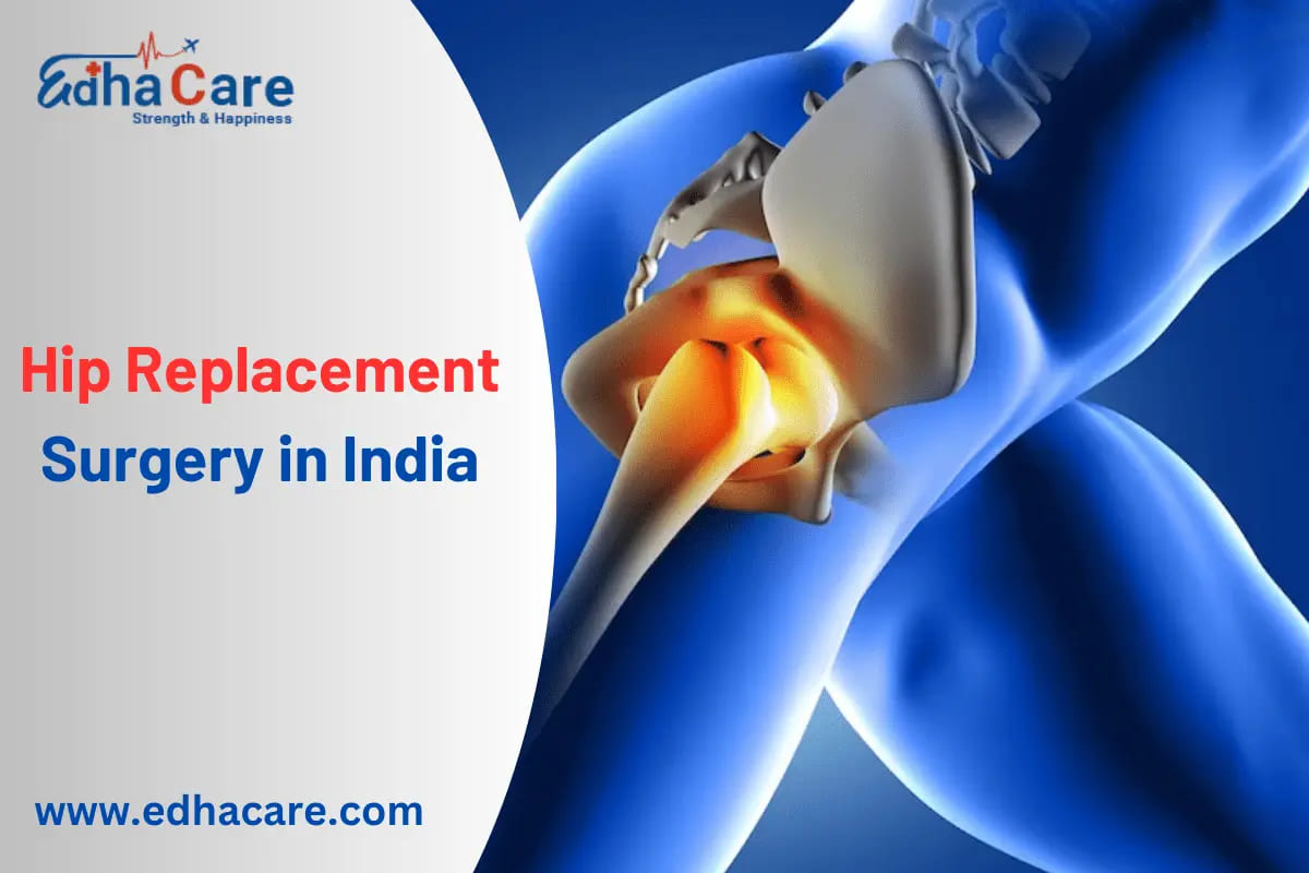 Hip Replacement Surgery In India