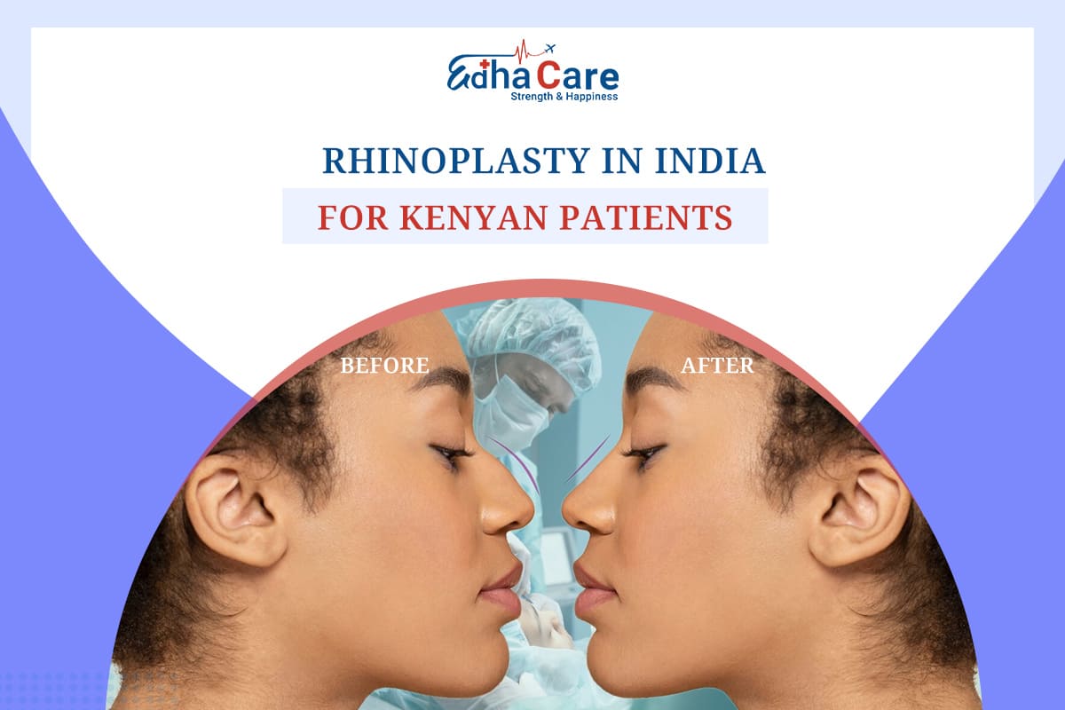 Rhinoplasty in India for Kenyan Patients